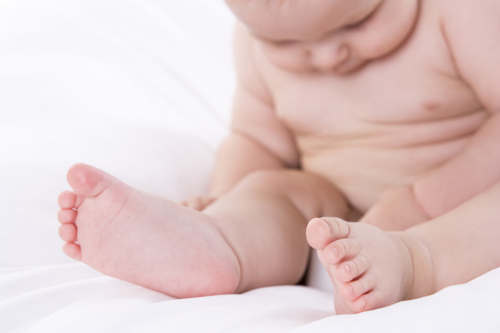 若い年齢での過体重による結腸がんのリスクが高い