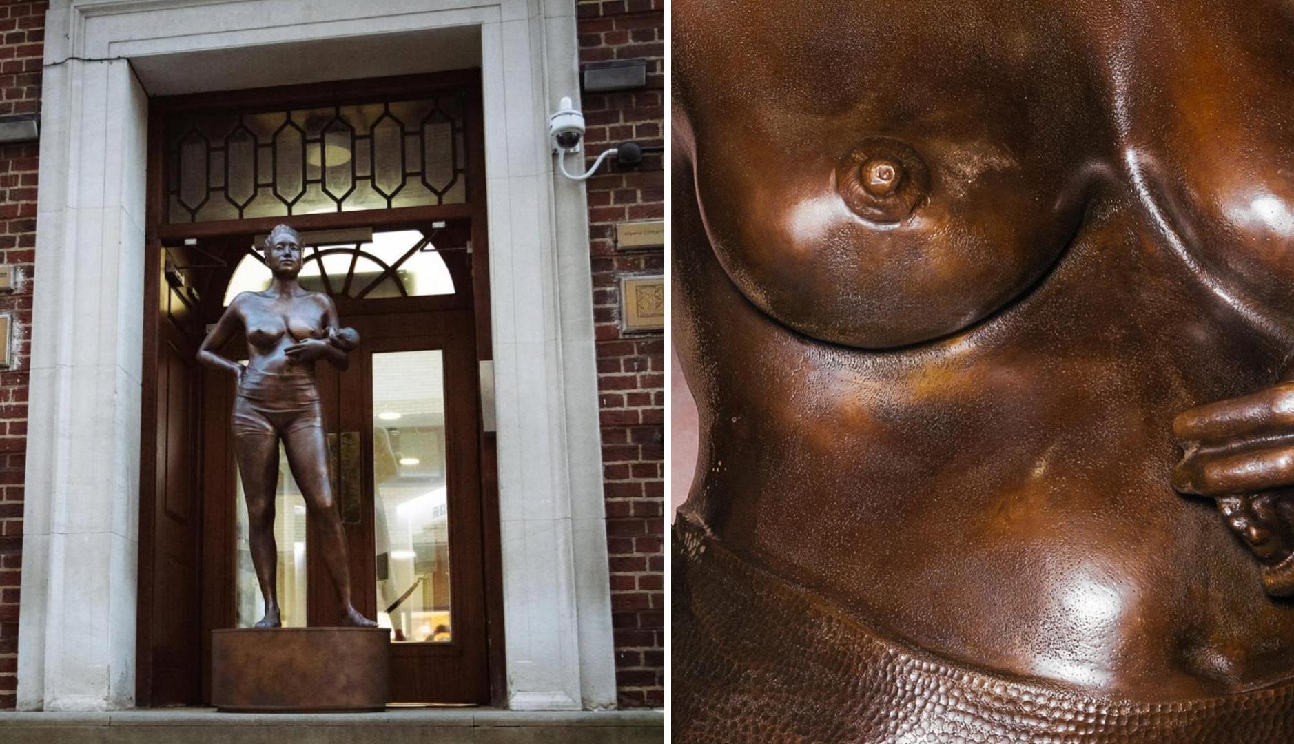 傷跡と腫れ物をブロンズで彫刻: フリーダは彫像で産後を可視化