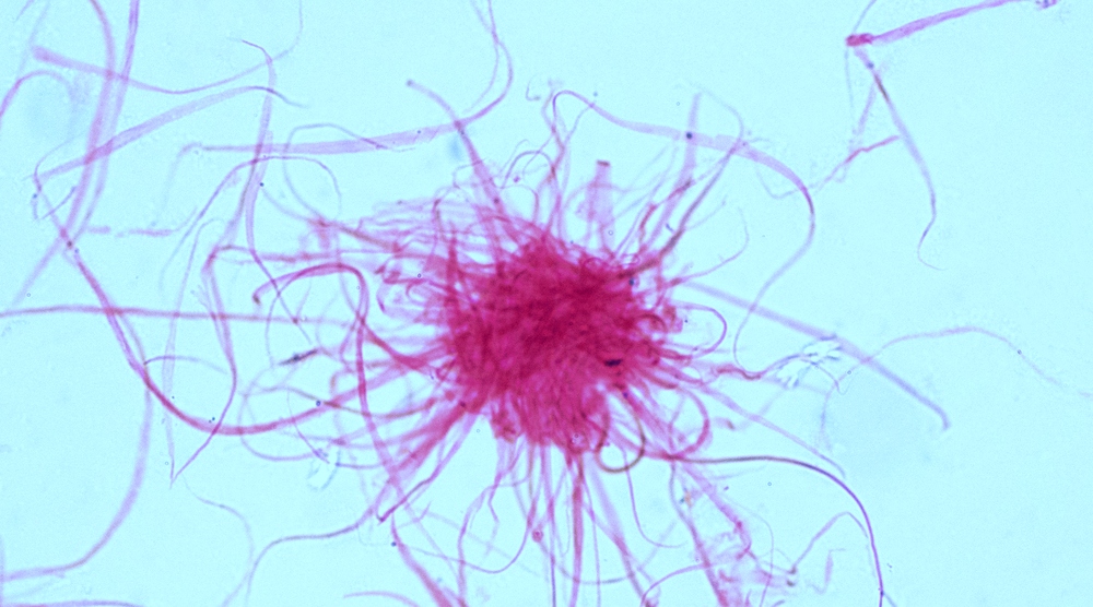 がん細胞の切断に関する Nature 出版物